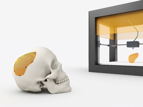 3D Printing Healthcare