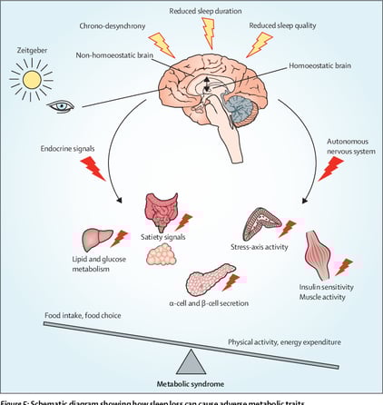 a chart showing a sleep deprived brain affects what all organs and why it affects metabolism. also showing a balancing figure between food choices and food intake (left and higher ) and physical exercise (right and lower)